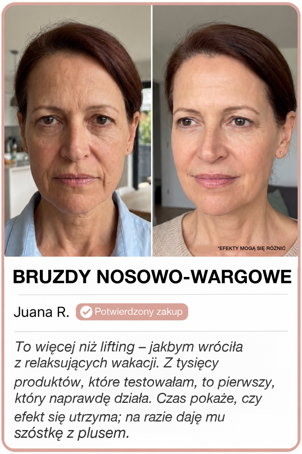 Przed i po z GoldLift