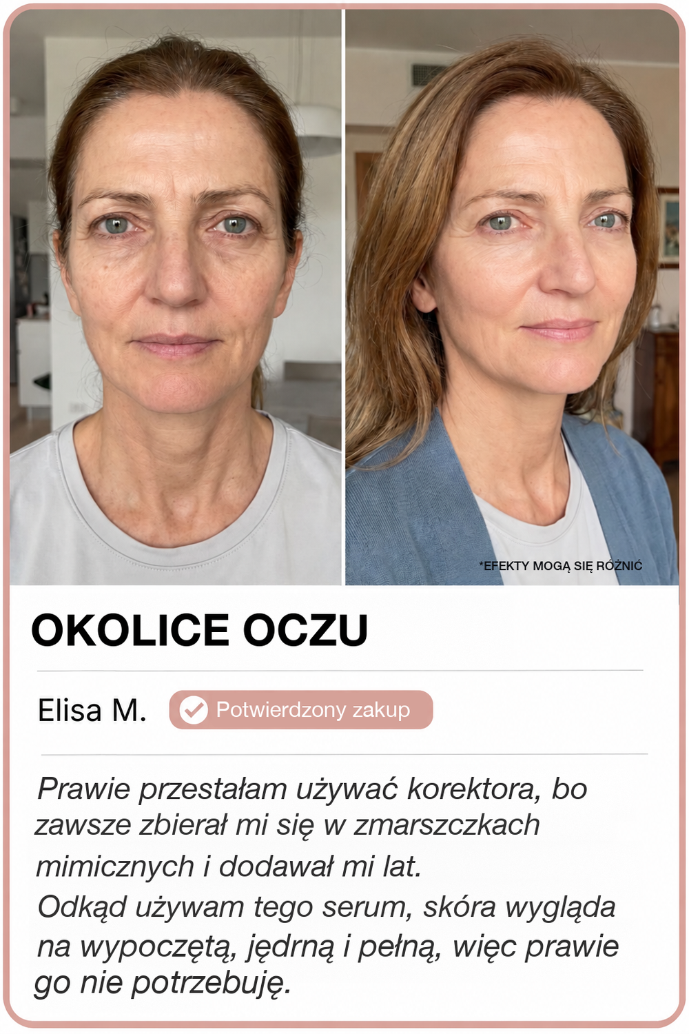 Przed i po z GoldLift