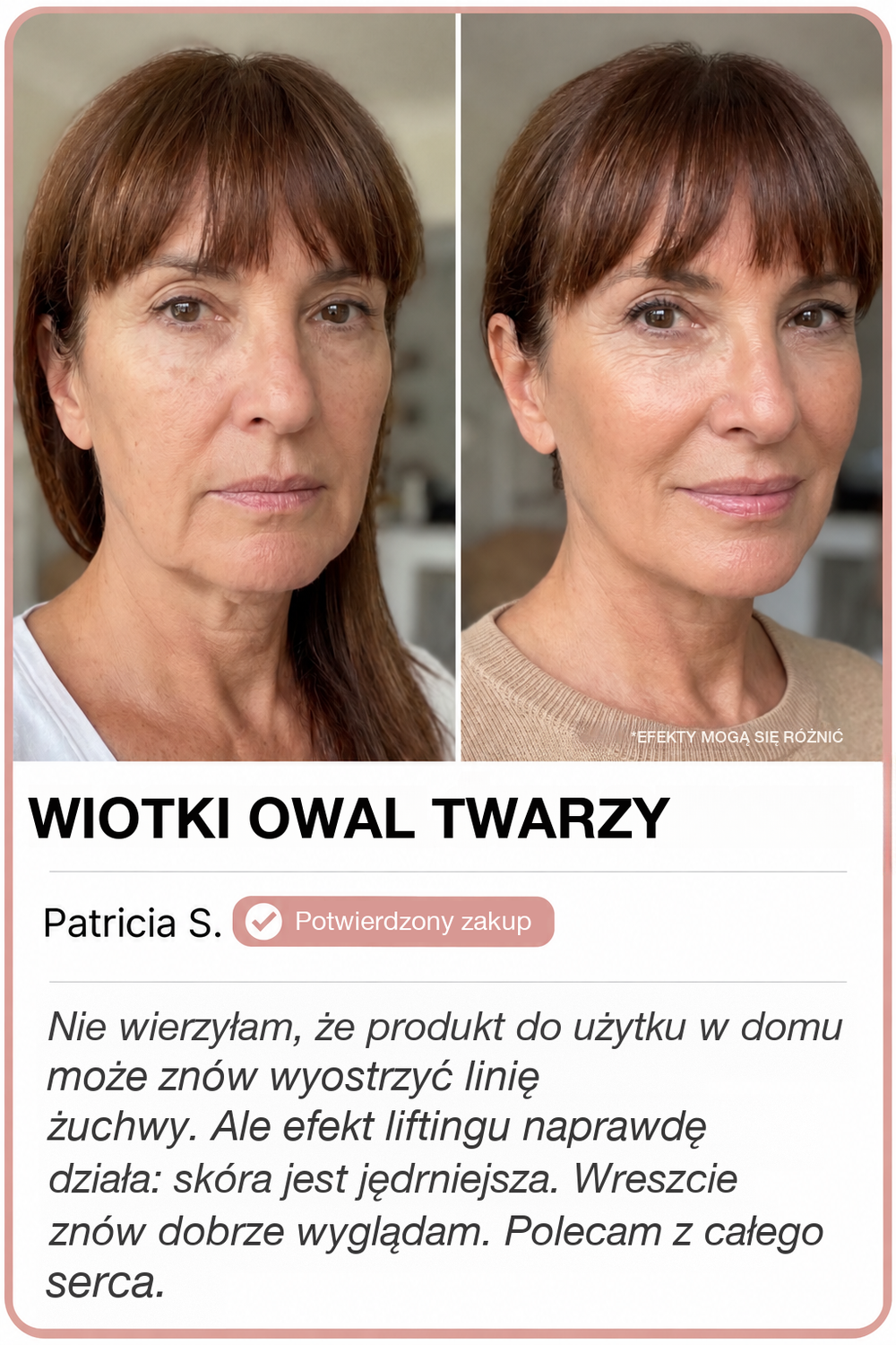 Przed i po z GoldLift