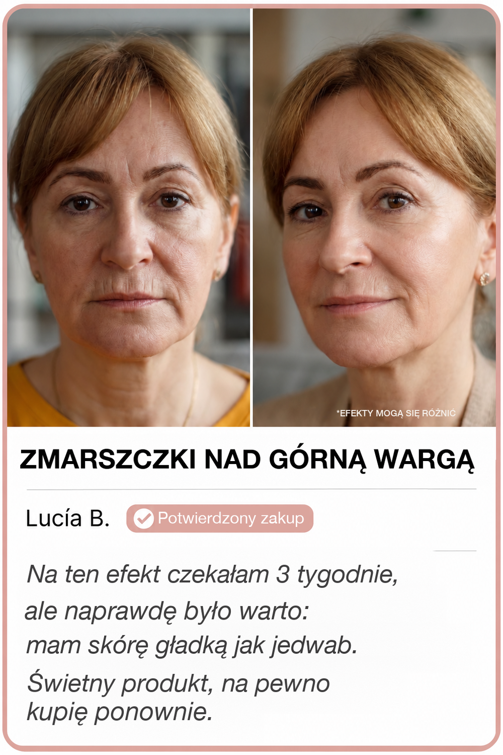 Przed i po z GoldLift