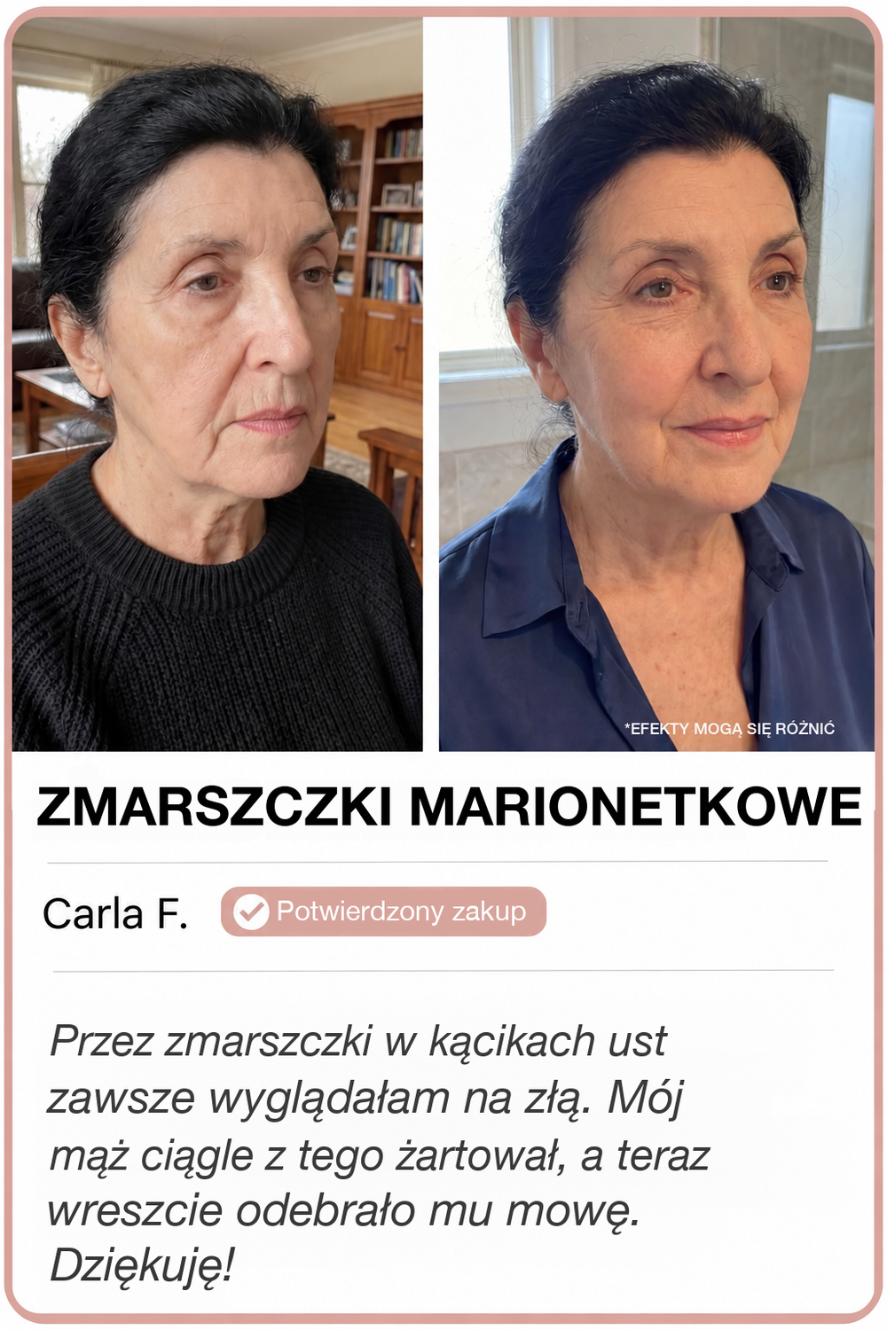 Przed i po z GoldLift
